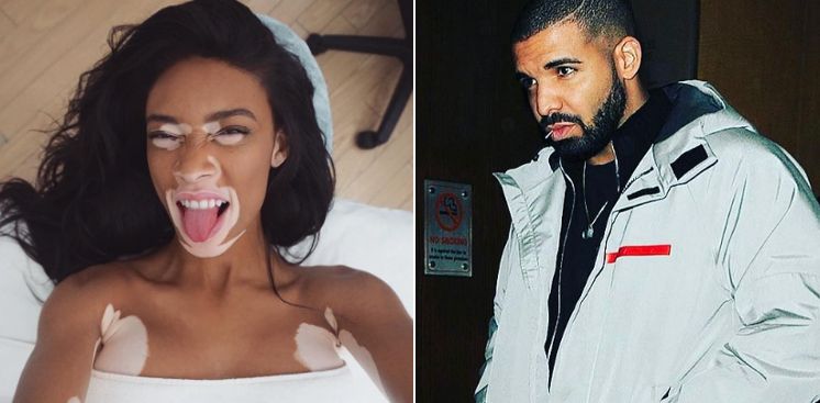 Drake Song Signs Louis Vuitton Inspired Winnie Harlow