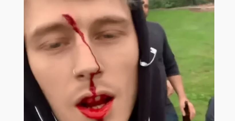Machine Gun Kelly Bloodied During Outing With Daughter And Young Thug