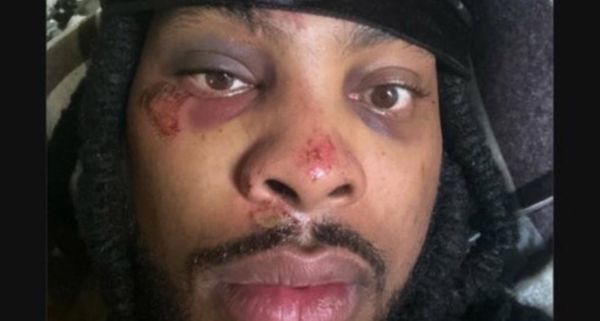 Waka Flocka Flame Updates Post about Getting Jumped by Ten Men